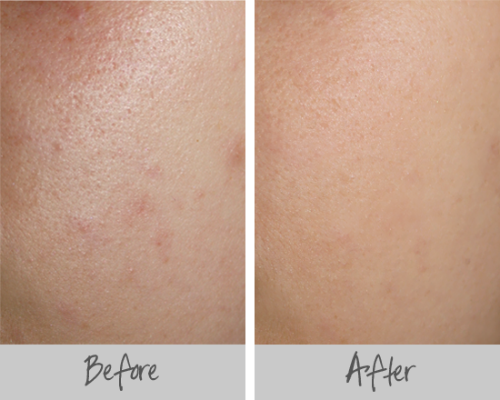 primer on skin before and after
